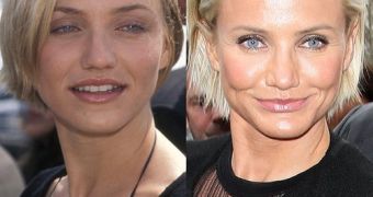 Cameron Diaz regrets using Botox, wants her natural face back