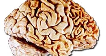 A brain showing degeneration of the frontal lobe, as seen in FTLD