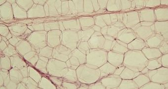 Fat Cells That Burn Calories Identified