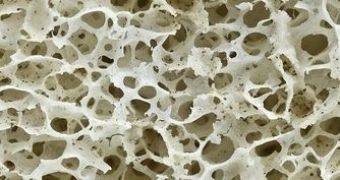 Low bone mineral density can lead to osteoporosis later in life
