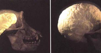 Chimp brain/human brain