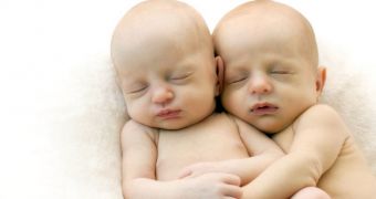 Conjoined twins were born in India