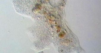 Amoebas such as this one live between contact lenses and the human eye and cause severe damage, including blindness