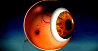 Eye implants can ensure a vision better than 20/20