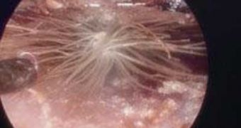 Dandelion Found Growing in Child's Ear Canal