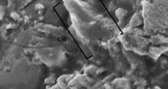 Carbon whisker embedded in CAI