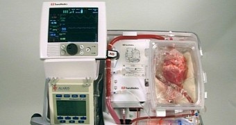 Photo shows the machine used to prepare the resuscitated hearts for surgery