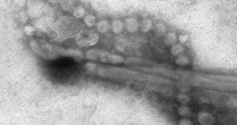 Electron microscope image of the H7N9 avian flu strain