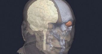 Snapshot from the computer model experts used to model a human head