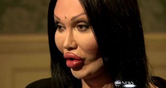 Pete Burns speaks of his plastic surgery addiction in new ABC special, says he’s not going to stop