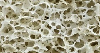 Bone density could be connected to prostate cancer