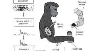 System under development of Northwestern University to stimulate hand movement after paralysis