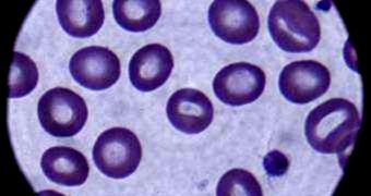 Red and white blood cells are shown through a microscope, magnification 100x
