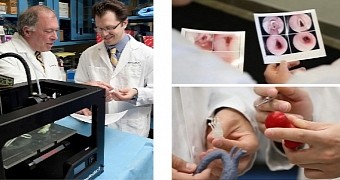 Doctors Use Normal 3D Printer to Create a Trachea