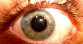 Contact lenses are almost invisible when applied to the eyes