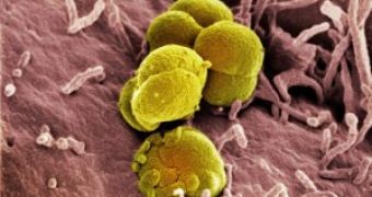 Drug resistant gonorrhea makes it all the way to North America