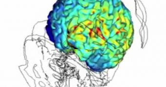 Electrical Brain Stimulation Quells Migraines