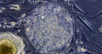 Stem cell sub-populations could someday offer scientists the key to stopping cancer metastasis