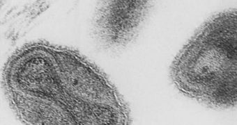 A picture of the Variola virus, which causes smallpox