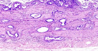 Estrogens and Gallbladder Cancer Share Connections