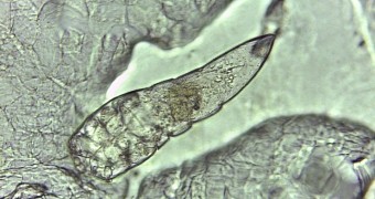 Meet Demodex brevis, one of the mite species living on your face