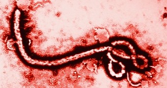 Scientists test experimental Ebola vaccine on people