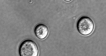 Cells from the yeast Saccharomyces cerevisiae, visualized here with DIC microscopy