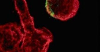 HIV's Nef protein acts on actin inside immune system cells, disrupting their mobility