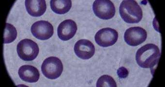 When faced with HAART drugs, HIV hides inside hematopoietic progenitor cells