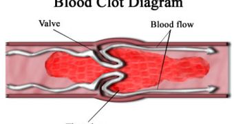 WUSM experts gain a better understanding of blood clotting