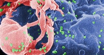 New strain of the HIV virus, called A3/02 is infecting more and more people in West Africa