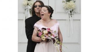 Face Transplant Recipient Marries Burn Victim in Texas – Photo