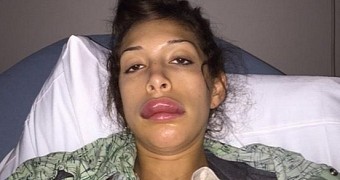 Farrah Abraham's botched plastic surgery leaves her with the biggest trout pout ever