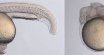 Side-by-side comparison of a normal zebrafish embryo and a zebrafish embryo lacking fatty acid pathways