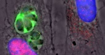 The cell at left is infected with the Toxoplasma gondii parasite, which can be seen in green. The cell on the right (with a blue nucleus) is not infected
