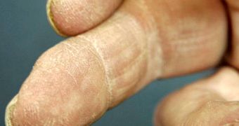 The regrown finger of Lee Spievak