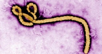 Patient admitted to hospital in Texas, US, diagnosed with Ebola
