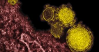 The MERS coronavirus (yellow) attached to DPP4 receptors on human lung cells