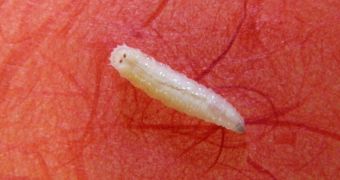 Woman is shocked to discover maggots have taken up residence inside her ear
