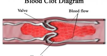An image detailing the make-up of a regular blood clot