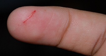 Freaky Friday Mystery: Why Paper Cuts Hurt like Absolute Hell
