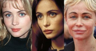 Emmanuelle Beart admits to having had her lips done, botched