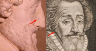 Two distinct markings seen in old representations of King Henry were found on the mummified head as well