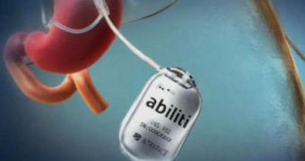 Abiliti is made up of a sensor installed in the stomach and an electrode stimulating the vague nerve