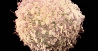 Clinical trials of a new gene-editing method for increasing resilience to HIV obtain encouraging results