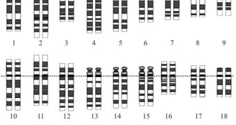 A representation of the human karyotype, showing the "n" number of cromosomes