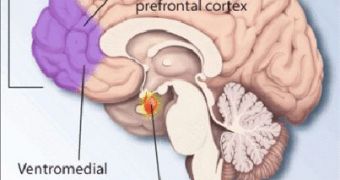 This image shows areas of the brain known to be involved in PTSD
