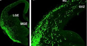 Genetic labeling enabled Huang's team to image very young GABA neurons soon after they left the place of their 'birth' (MGE) and as they migrated into two layers of the mouse cortex (MZ and SVZ)