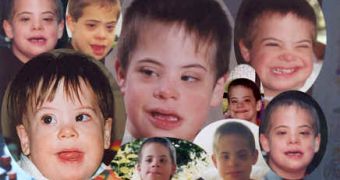 Children with Down syndrome