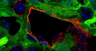 Glioblastoma tumor cells (shown in green) can transform into endothelial cells (shown in red), which line the interior surface of a tumor vessel.